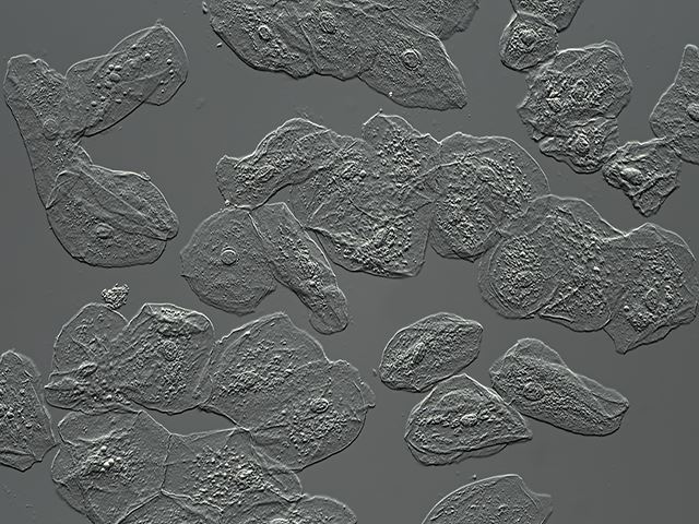 Human oral mucosa