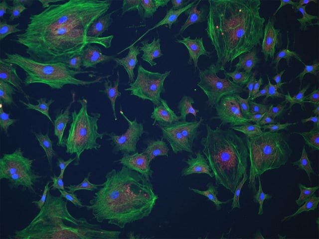 Channel Fluorescence
